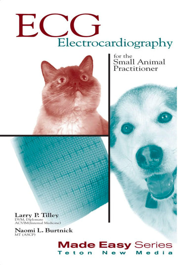 ECG Electrocardiography